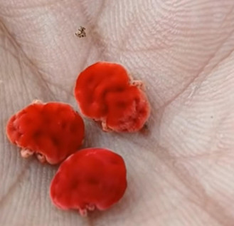 Schritt zur Selbstermächtigung, zur Selbstverwirklichung